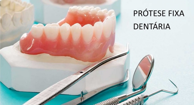 Financial support for the acquisition of dental prostheses