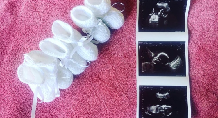 Triplets on their way... how will it be?